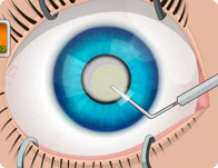 Operate Now: Eye Surgery